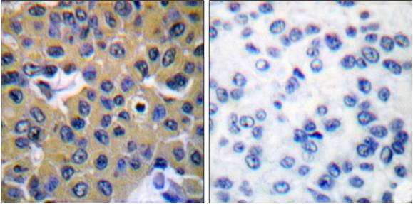 SHP-2 (Phospho-Tyr542) antibody