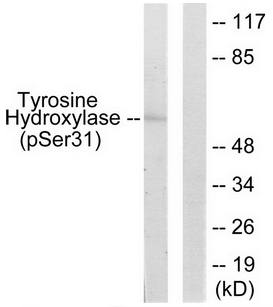 Tyrosine Hydroxylase (Phospho-Ser31) antibody