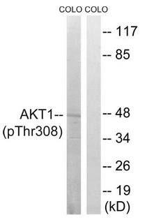 Akt (Phospho-Thr308) Antibody