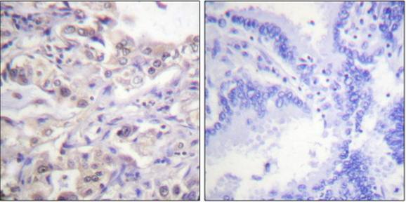 hnRPD (Phospho-Ser83) Antibody