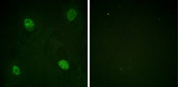 hnRPD (Phospho-Ser83) Antibody