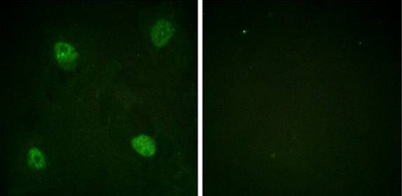 hnRPD (Phospho-Ser83) antibody