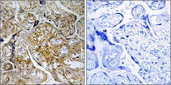 PAK1 (Phospho-Ser199) Antibody