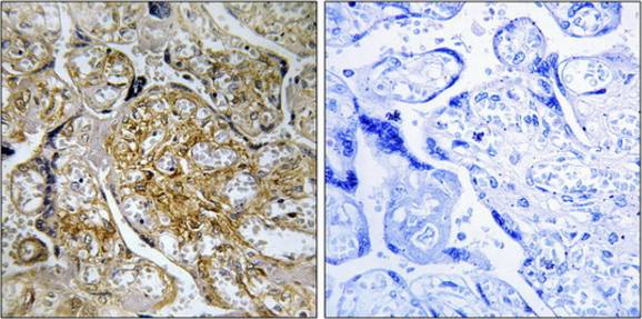 PAK1 (Phospho-Ser199) antibody