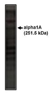 Rabbit Rat Calcium Channel Antibody