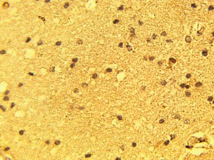 Rabbit Rat Calcium Channel Antibody