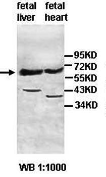 A1CF Rabbit Polyclonal Antibody