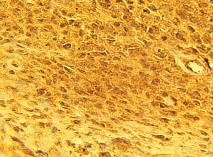 Rabbit Human Calcium Channel Antibody