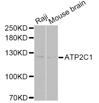 ATP2C1 antibody