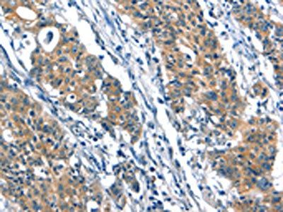 A4GALT Antibody