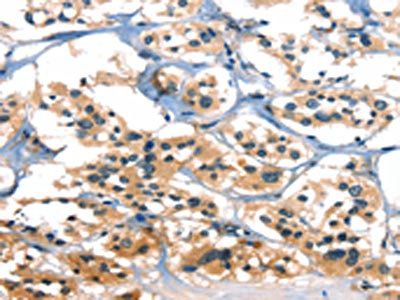 A4GALT Antibody