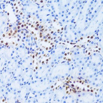 ANP32A antibody