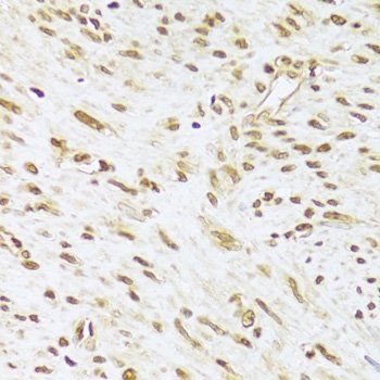 ANP32A antibody