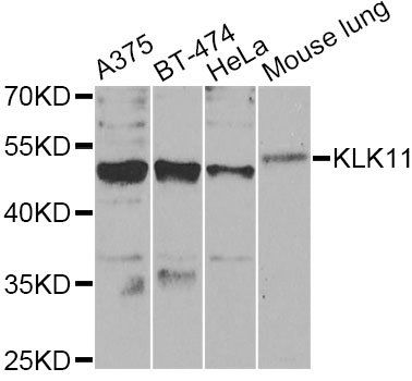 KLK11 antibody