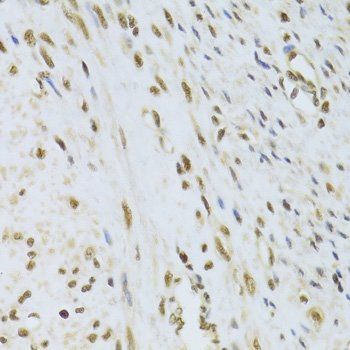 PPP1R8 antibody