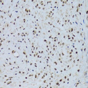 PPP1R8 antibody