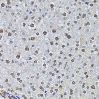 PPP1R8 antibody