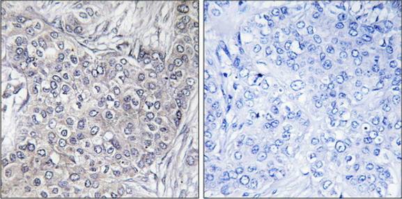 4E-BP1 (Phospho-Thr45) Antibody