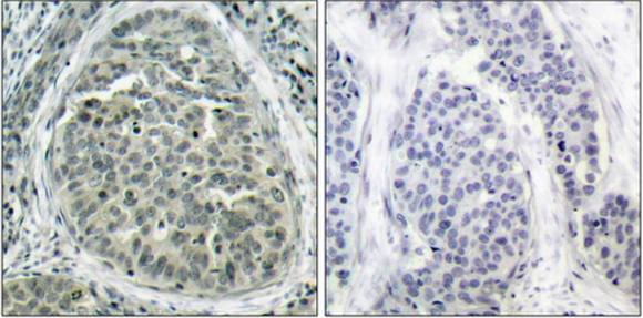 Catenin-beta (Phospho-Ser37) antibody