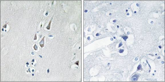 CaMK2 (Phospho-Thr286) Antibody