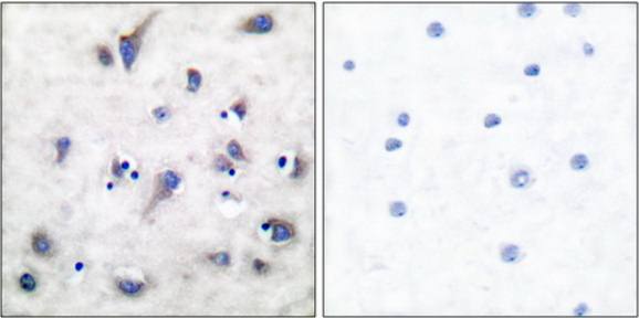 DARPP-32 (Phospho-Thr34) antibody