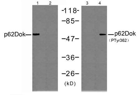 p62 Dok (Phospho-Tyr362) Antibody