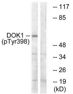 p62 Dok (Phospho-Tyr398) Antibody