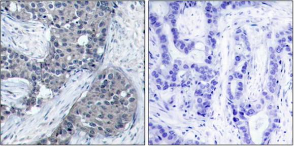 eIF4E (Phospho-Ser209) Antibody