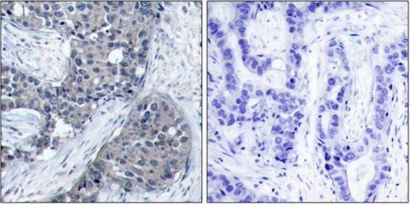 eIF4E (Phospho-Ser209) antibody