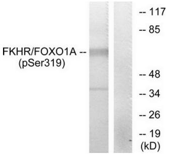 FKHR (Phospho-Ser319) antibody