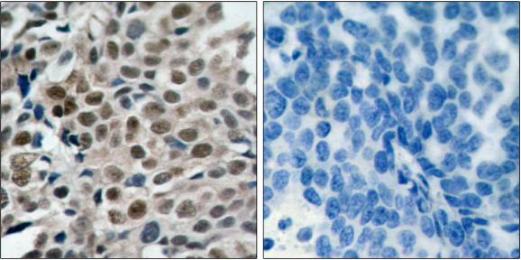 FKHRL1 (Phospho-Ser253) antibody