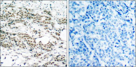 AFX (Phospho-Ser197) Antibody