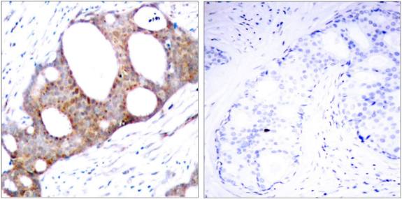 GSK3α (Phospho-Ser21) Antibody