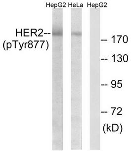 HER2 antibody