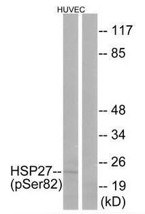 HSP27 (Phospho-Ser82) Antibody