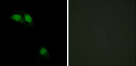 IRS-1 (Phospho-Ser312) Antibody