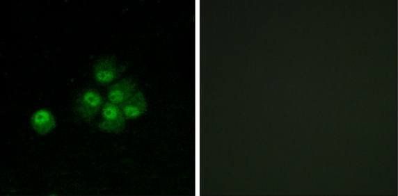 IRS-1 (Phospho-Ser636) Antibody