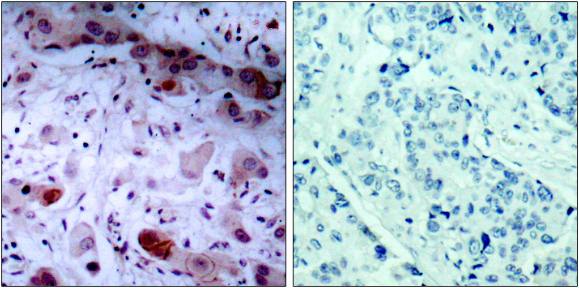 JAK1 (Phospho-Tyr1022) Antibody
