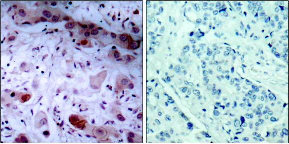 JAK1 (Phospho-Tyr1022) antibody