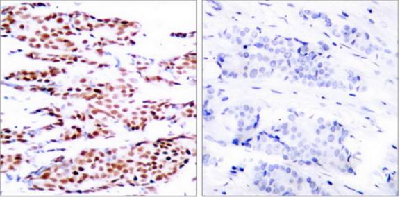 JunB (Phospho-Ser79) Antibody