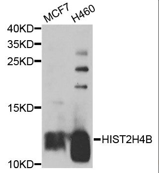 HIST2H4B antibody