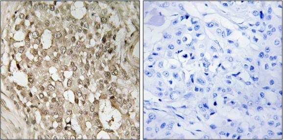 NFkB p65 (Phospho-Ser529) antibody