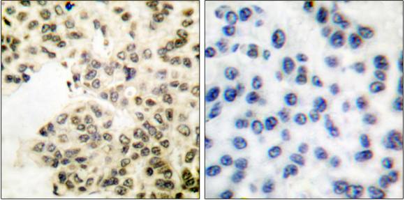 NFkB p65 (Phospho-Ser311) antibody