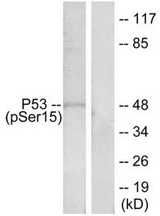 p53 (Phospho-Ser15) antibody