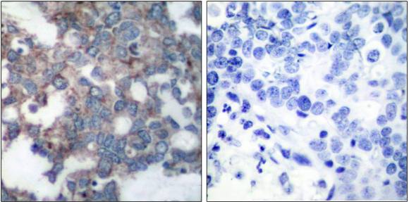 p70 S6 Kinase (Phospho-Ser424) antibody