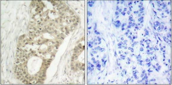 PKC delta (Phospho-Ser645) antibody