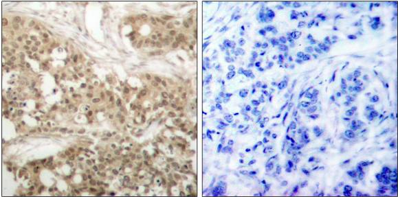 PKC θ (Phospho-Ser676) Antibody