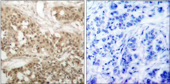 PKC theta (Phospho-Ser676) antibody