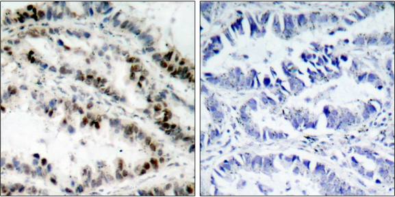 SMC1 (Phospho-Ser957) antibody