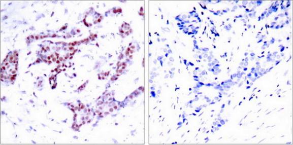 STAT1 (Phospho-Tyr701) Antibody